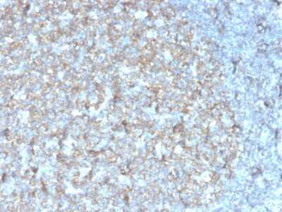 Immunohistochemistry-Paraffin: CD81 Antibody (rC81/3442) [NBP3-07474]