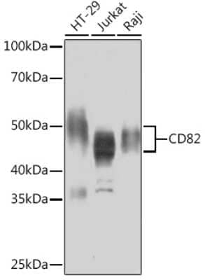 Western Blot: CD82/Kai-1 Antibody (0T3L6) [NBP3-16797]