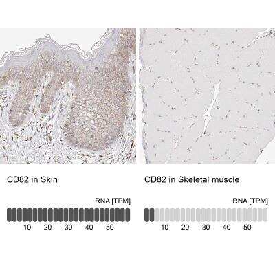 Immunohistochemistry-Paraffin: CD82/Kai-1 Antibody [NBP1-81627]