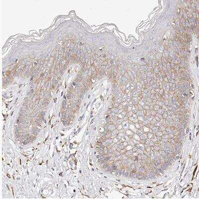 Immunohistochemistry-Paraffin: CD82/Kai-1 Antibody [NBP1-81627]