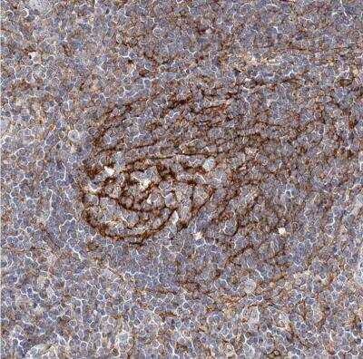 Immunohistochemistry-Paraffin: CD82/Kai-1 Antibody [NBP1-81627]