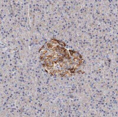 Immunohistochemistry-Paraffin: CD82/Kai-1 Antibody [NBP1-81627]
