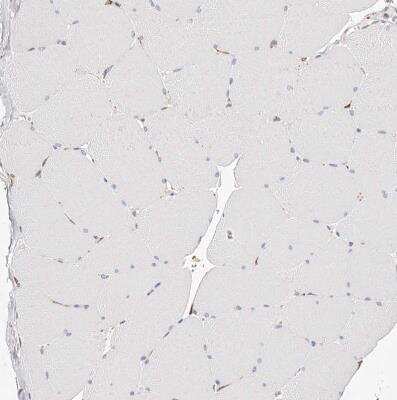 Immunohistochemistry-Paraffin: CD82/Kai-1 Antibody [NBP1-81627]