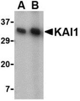 Western Blot: CD82/Kai-1 AntibodyBSA Free [NBP1-76775]