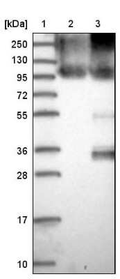 Western Blot: CD82/Kai-1 Antibody [NBP1-81627]