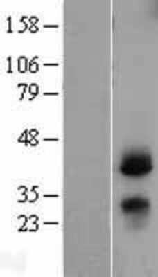 Western Blot: CD82/Kai-1 Overexpression Lysate [NBL1-08974]