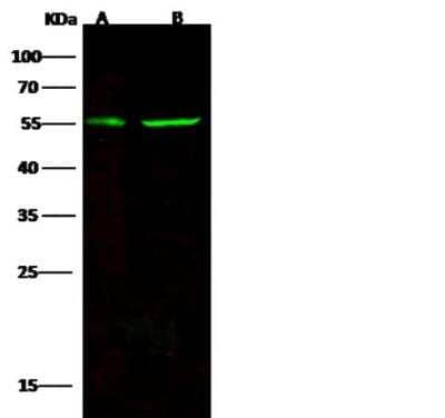 Western Blot: CD83 Antibody (104) [NBP2-89980]