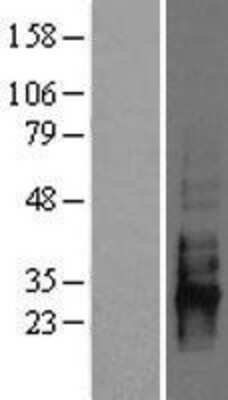 Western Blot: CD83 Overexpression Lysate [NBL1-08975]