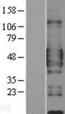 Western Blot: CD84/SLAMF5 Overexpression Lysate [NBL1-08977]