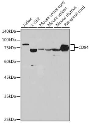 Western Blot: CD84/SLAMF5 Antibody (0N8J7) [NBP3-16110]