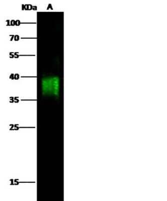 Western Blot: CD84/SLAMF5 Antibody (6) [NBP2-89267]