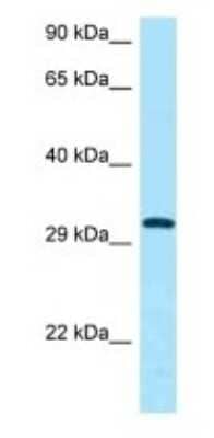 Western Blot: CD84/SLAMF5 Antibody [NBP1-98409]