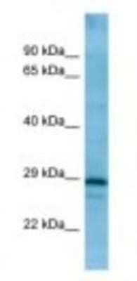 Western Blot: CD84/SLAMF5 Antibody [NBP1-98410]