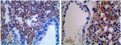 Immunohistochemistry-Paraffin: B7-2/CD86 Antibody (AP-MAB0803) - Azide and BSA Free [NBP2-12182]