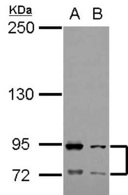 Western Blot: FCAR/CD89 Antibody [NBP2-15820]