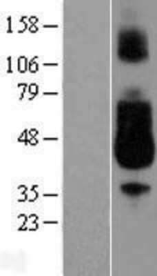 Western Blot: FCAR/CD89 Overexpression Lysate [NBL1-10649]