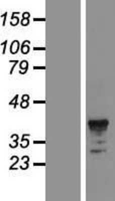 Western Blot: FCAR/CD89 Overexpression Lysate [NBP2-05715]