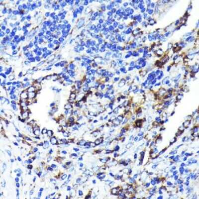 Immunohistochemistry-Paraffin: CD9 Antibody (10N2L6) [NBP3-15593]