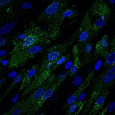 Immunocytochemistry/ Immunofluorescence: CD9 Antibody (5G6) - BSA Free [NBP2-22187]