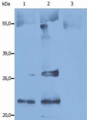 Immunoprecipitation: CD9 Antibody (IVA50) - BSA Free [NB500-494]