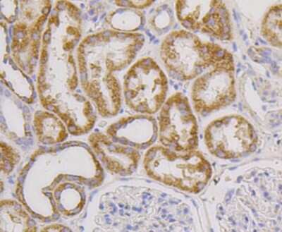 Immunohistochemistry-Paraffin: CD9 Antibody (SA35-08) [NBP2-67310]