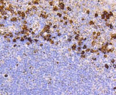 Immunohistochemistry-Paraffin: CD9 Antibody (SA35-08) [NBP2-67310]