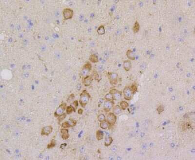 Immunohistochemistry-Paraffin: CD9 Antibody (SA35-08) [NBP2-67310]