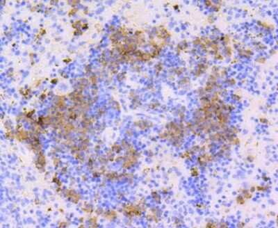Immunohistochemistry-Paraffin: CD9 Antibody (SA35-08) [NBP2-67310]