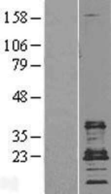 Western Blot: CD9 Overexpression Lysate [NBL1-08982]