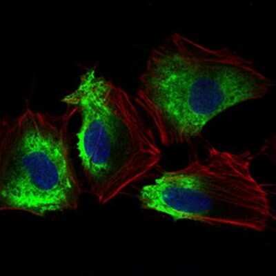 Immunocytochemistry/ Immunofluorescence: CD90/Thy1 Antibody (7E1B11) - BSA Free [NBP2-37330]