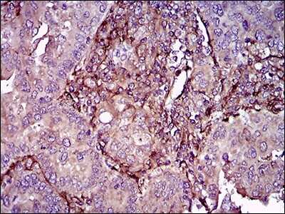 Immunohistochemistry-Paraffin: CD90/Thy1 Antibody (7E1B11) - BSA Free [NBP2-37330]