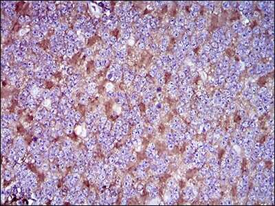 Immunohistochemistry-Paraffin: CD90/Thy1 Antibody (7E1B11) - BSA Free [NBP2-37330]