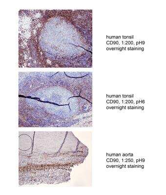 Immunohistochemistry-Paraffin: CD90/Thy1 Antibody (7E1B11) - BSA Free [NBP2-37330]