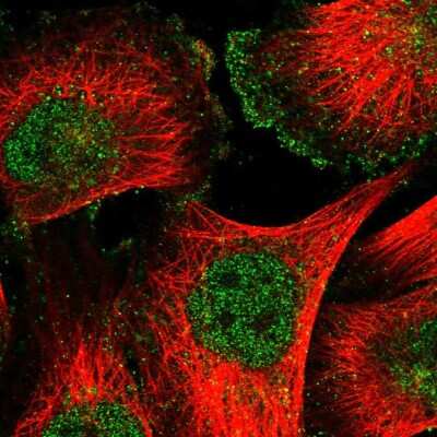 Immunocytochemistry/ Immunofluorescence: CD90/Thy1 Antibody [NBP1-85739]