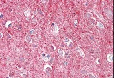 Immunohistochemistry-Paraffin: CD90/Thy1 Antibody [NBP1-51963]