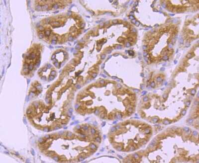 Immunohistochemistry-Paraffin: CD90/Thy1 Antibody (JF10-09) [NBP2-66763]