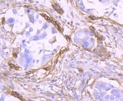 Immunohistochemistry-Paraffin: CD90/Thy1 Antibody (JF10-09) [NBP2-66763]