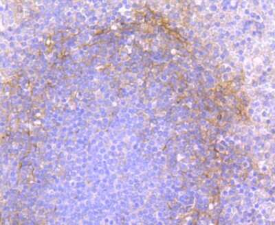Immunohistochemistry-Paraffin: CD90/Thy1 Antibody (JF10-09) [NBP2-66763]