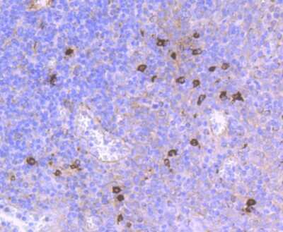 Immunohistochemistry-Paraffin: CD90/Thy1 Antibody (JF10-09) [NBP2-66763]