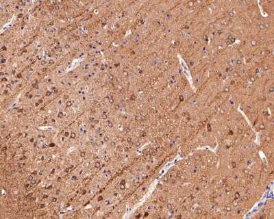 Immunohistochemistry-Paraffin: CD90/Thy1 Antibody (JF10-09) [NBP2-66763]