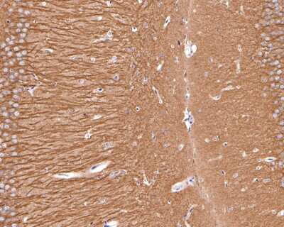 Immunohistochemistry-Paraffin: CD90/Thy1 Antibody (JF10-09) [NBP2-66763]