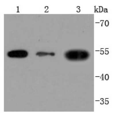 Western Blot: CD90/Thy1 Antibody (JF10-09) [NBP2-66763]