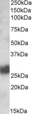 Western Blot: CD90/Thy1 Antibody [NBP1-51963]