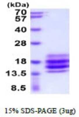 SDS-PAGE: Recombinant Human CD90/Thy1 His Protein [NBP2-52389]