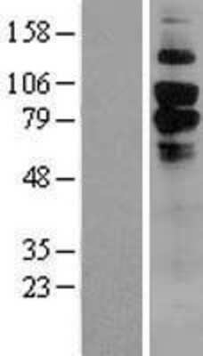 Western Blot: C1qR1/CD93 Overexpression Lysate [NBL1-08983]