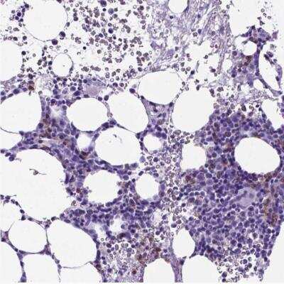 Immunohistochemistry-Paraffin: CD94 Antibody [NBP2-48815]