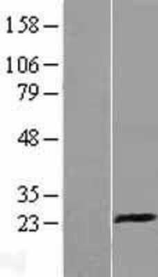 Western Blot: CD94 Overexpression Lysate [NBL1-12365]