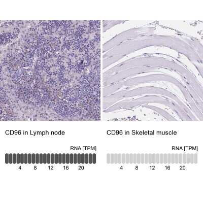 Immunohistochemistry-Paraffin: CD96 Antibody [NBP2-49491]