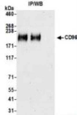 Immunoprecipitation: CD96 Antibody (BLR065G) [NBP3-14682]