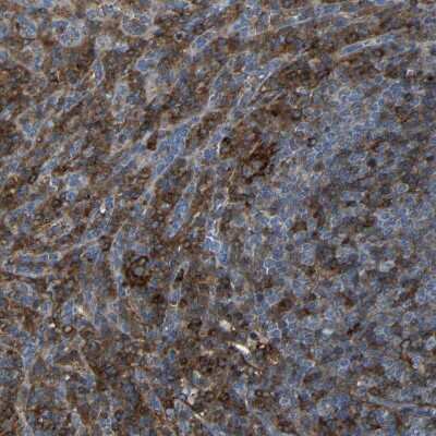 Immunohistochemistry-Paraffin: CD97 Antibody [NBP1-86935]